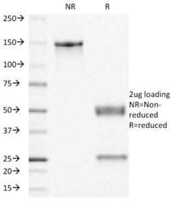 Progesterone R/NR3C3 Antibody (PR501), Novus Biologicals 0.2mg; Unlabeled:Antibodies,